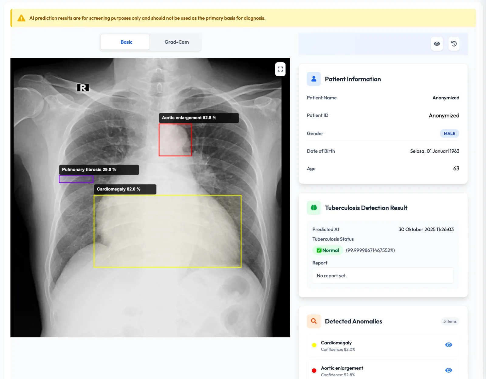 Oncodoc AI preview